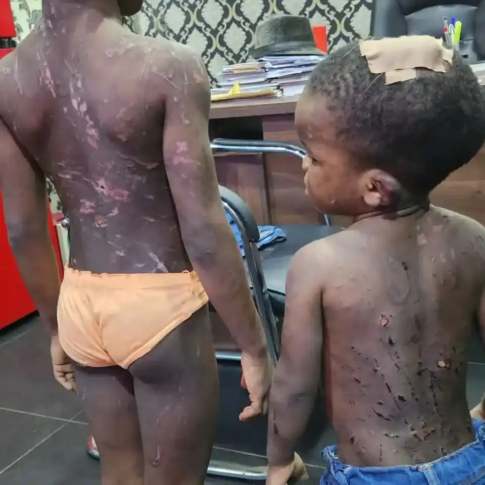 Police Arrest Couple In Lagos For Inflicting Injuries On Kids