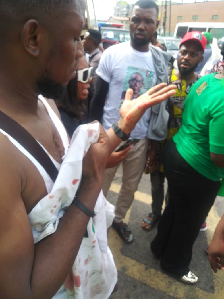 APC Thugs Attack Labour Party Supporters In Lagos
